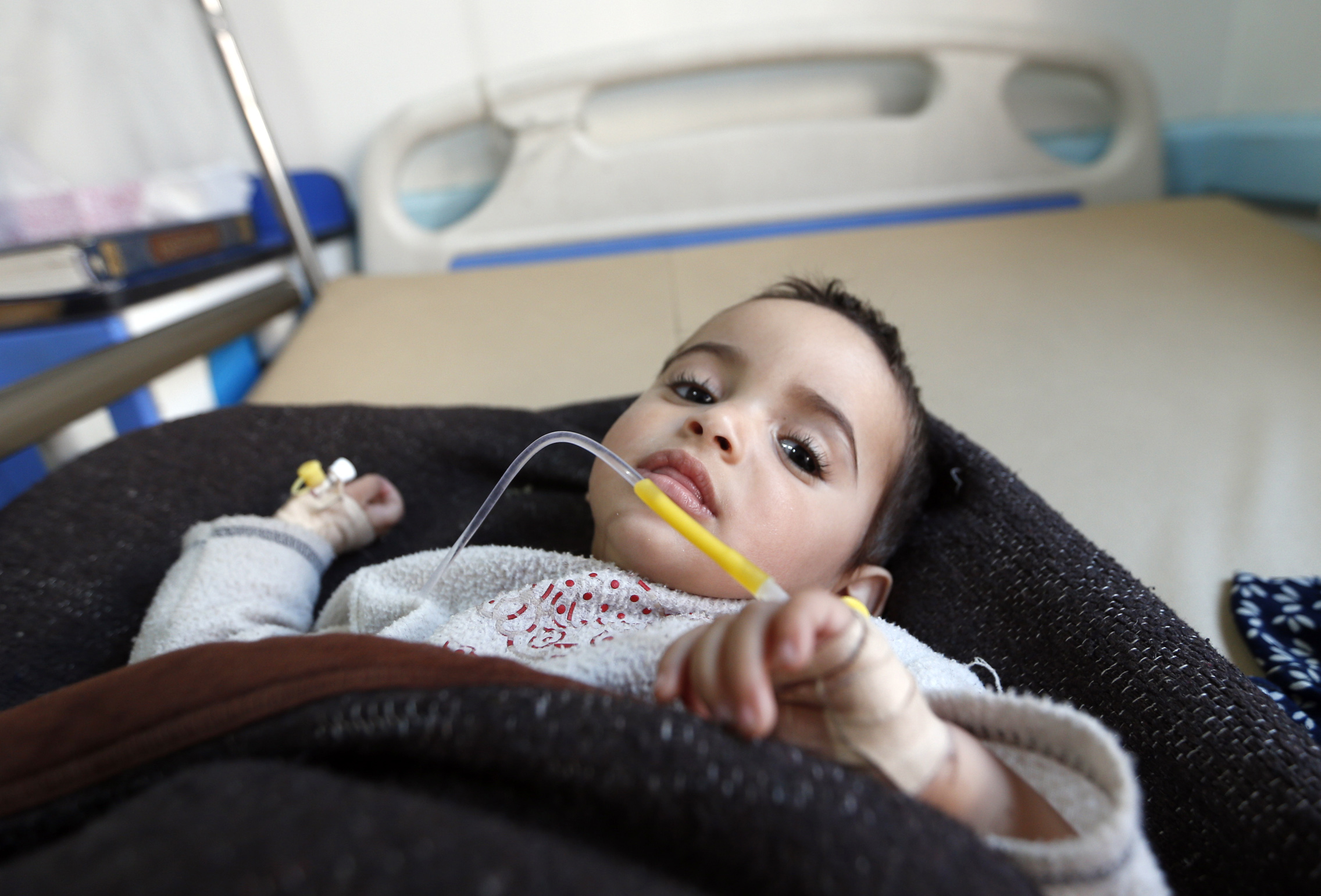 A picture of a Yemeni child lying on a hospital bed 
