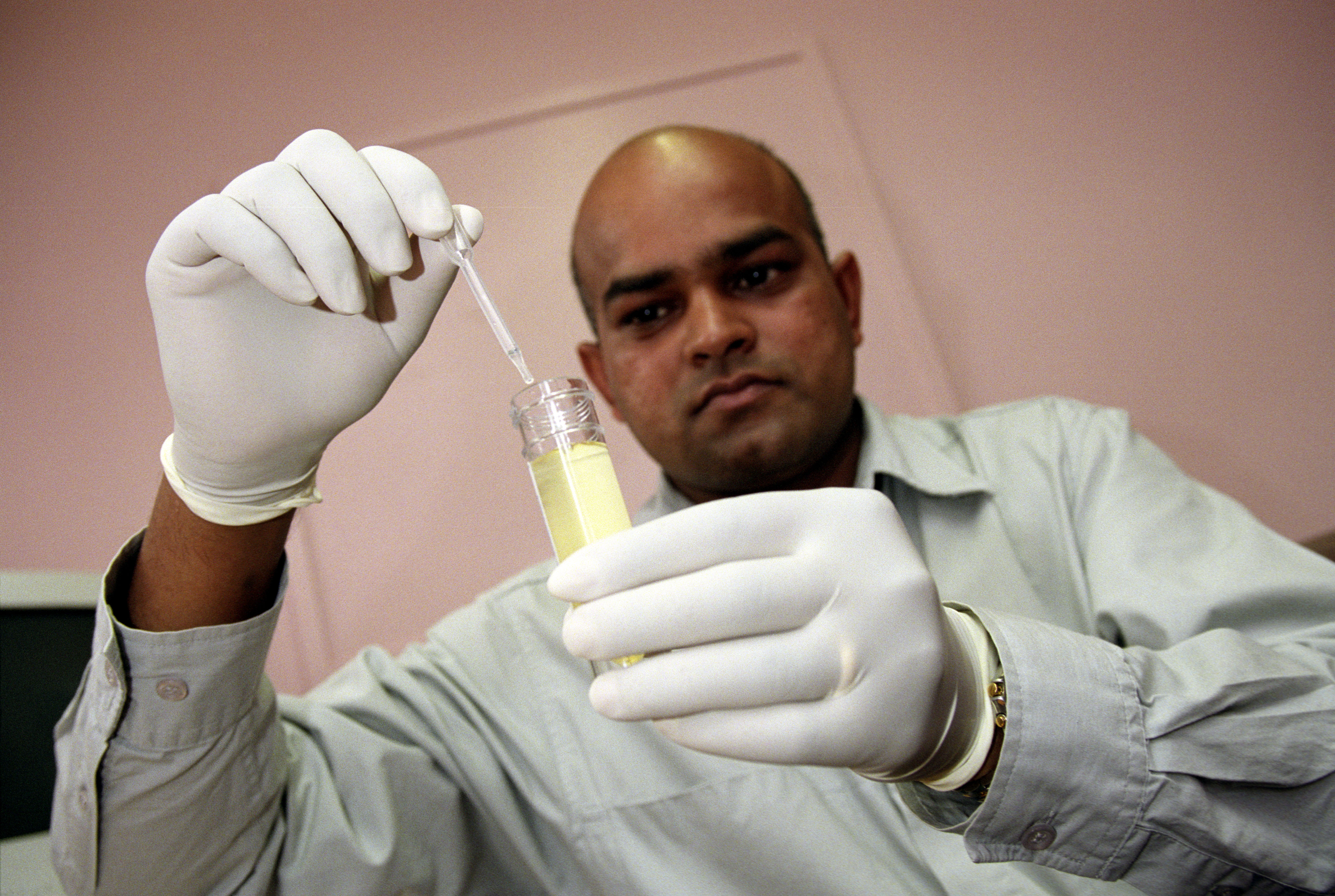 A drug counselor tests urine for traces of drugs. 