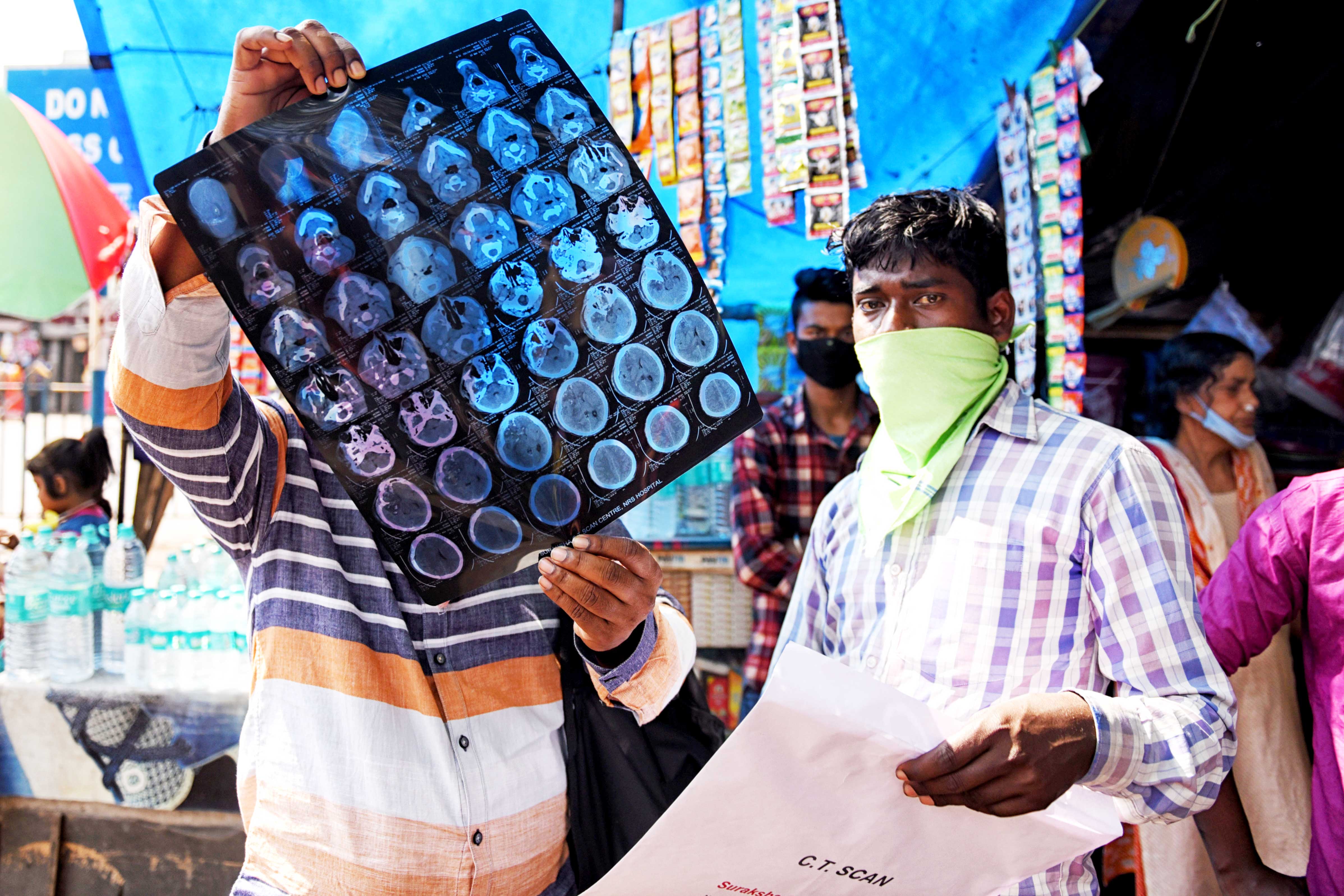 A patient with flu-like symptoms checks a CT scan in Kolkata, India.