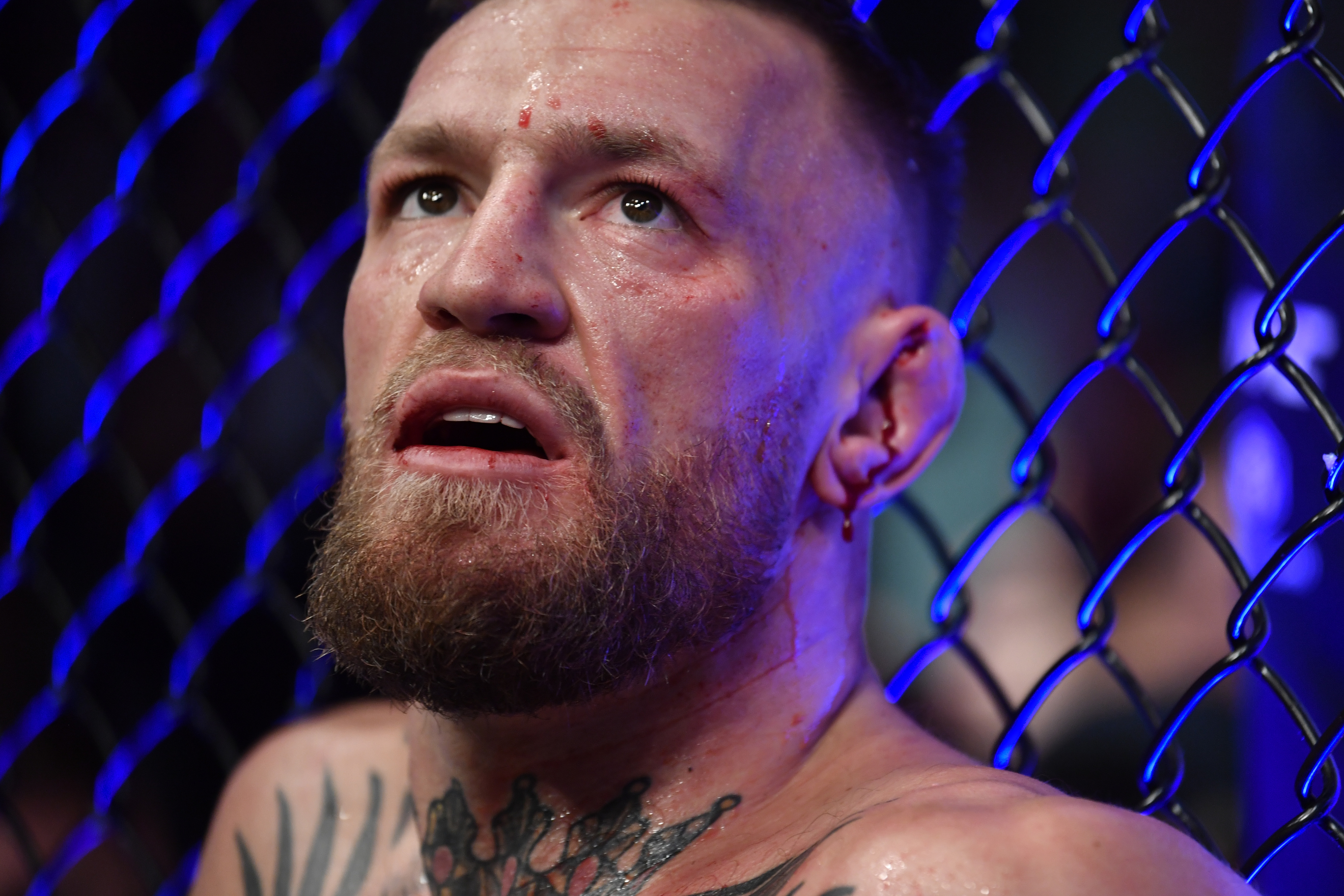Conor McGregor says he may have entered UFC 264 with a compromised left leg. 