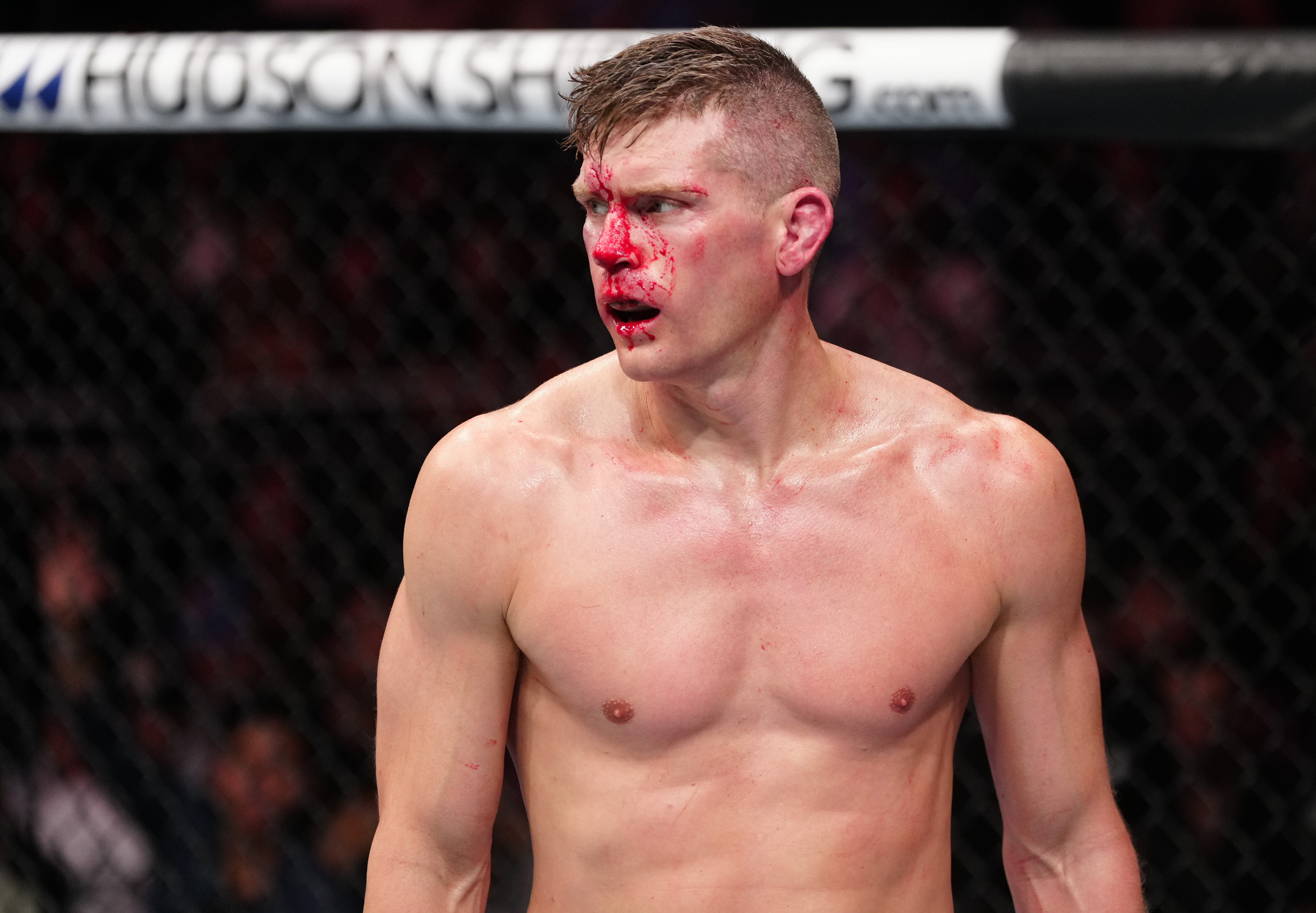 A bloodied Stephen Thompson at UFC Orlando. 